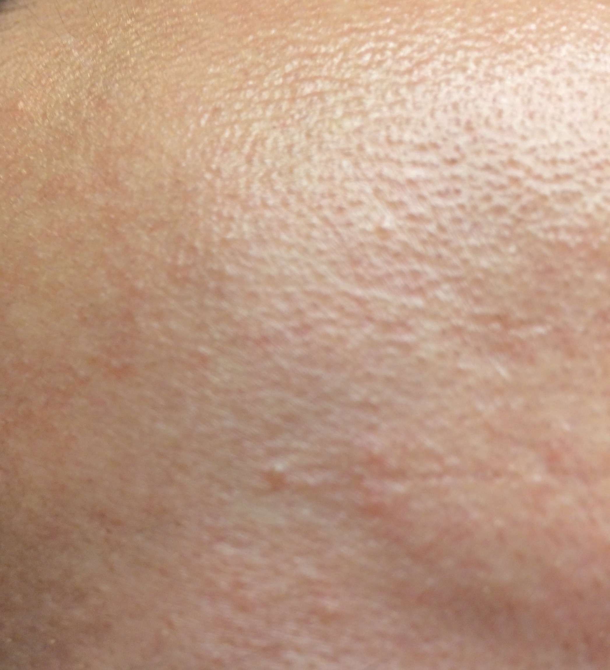 In welcher Reihenfolge Gesichtsmasken auftragen? (Gesundheit, Beauty, Haut)