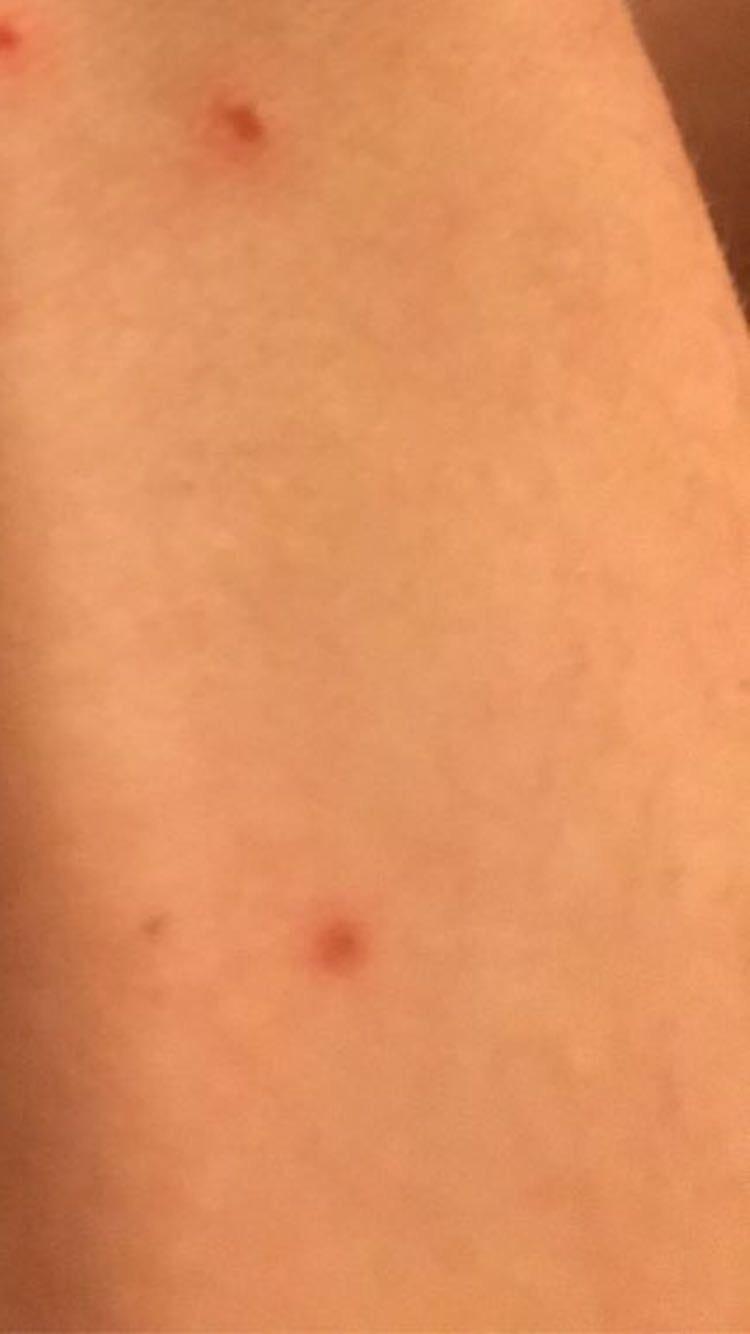 Wie Bekommt Man Wimpernkleber Von Der Haut Ab