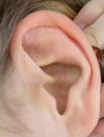 Industrial Piercing bei meinem Ohr möglich?