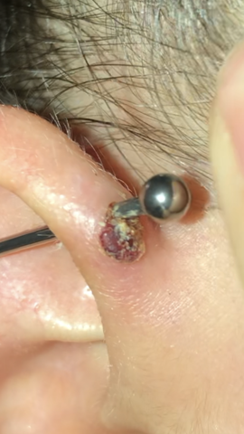industrial piercing entzundet blutwunde wie soll ich vorgehen gesundheit und medizin piercing stechen piercingpflege