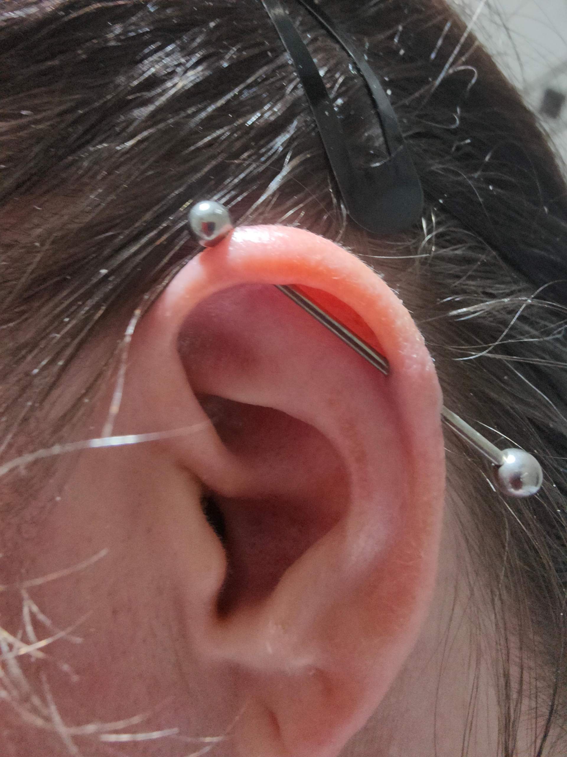 Industrial Piercing entzündet oder doch was anderes bitte um Hilfe? (Piercingschmuck