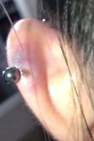 industrial piercing evtl entzundet haut ist lila gesundheit und medizin ohrknorpelpiercing