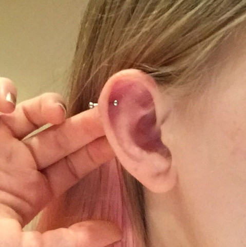 Helix
 - (Piercing, Ohr, Helix)