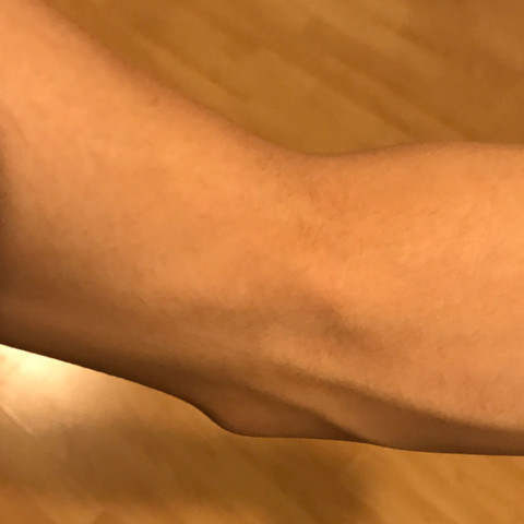 Knochen guckt raus innen Oberarm zu dünn - (Training, Arm, Oberarm)