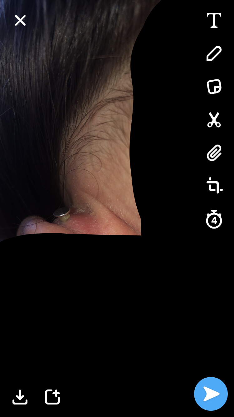 inner conch Piercing entzündet? (Gesundheit und Medizin, Entzündung, Piercer)