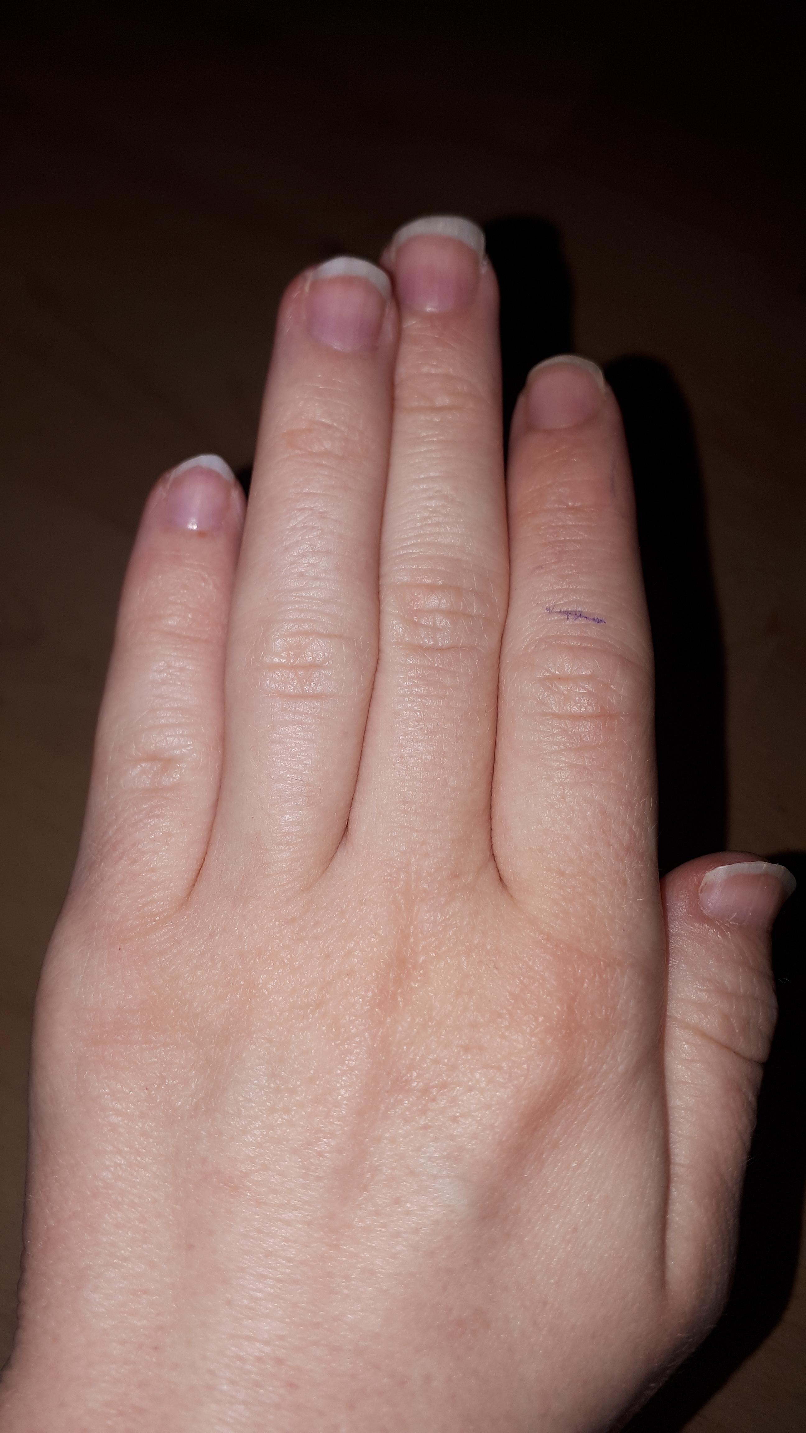 Irgendwas stimmt mit meinem Fingernägeln nicht, die sind rosa und in ...