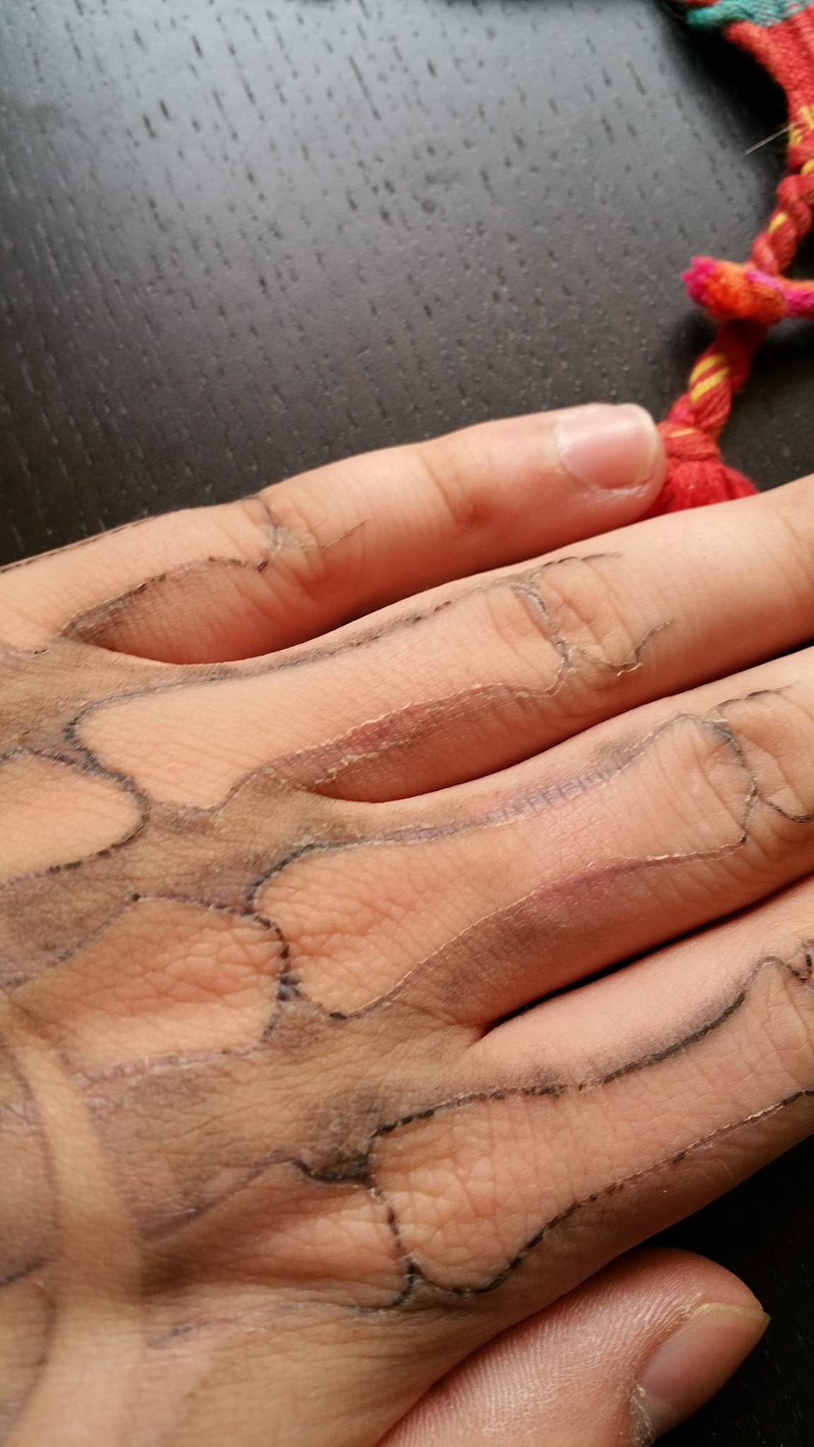Is das Normal? Tattoo mit weißen Ränden?