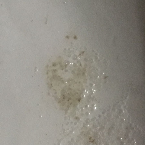 Ist Brauner Auswurf Siehe Bild Im Hustenschleim Nach Rauchstopp Normal Gesundheit Und Medizin Rauchen Husten Ist Brauner Auswurf Siehe Bild Im Hustenschleim Nach Rauchstopp Normal Gesundheit Und Medizin Rauchen Husten