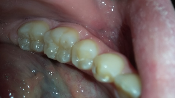 Zahn1 - (Zähne, Zahnarzt, Zahnmedizin)