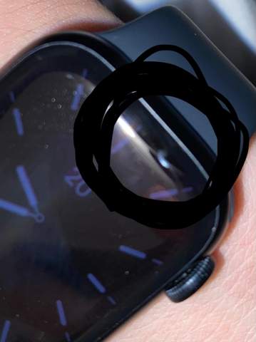 Ist das bei der neuen Apple Watch Normal?