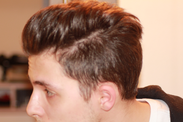 ist das bereits haarausfall