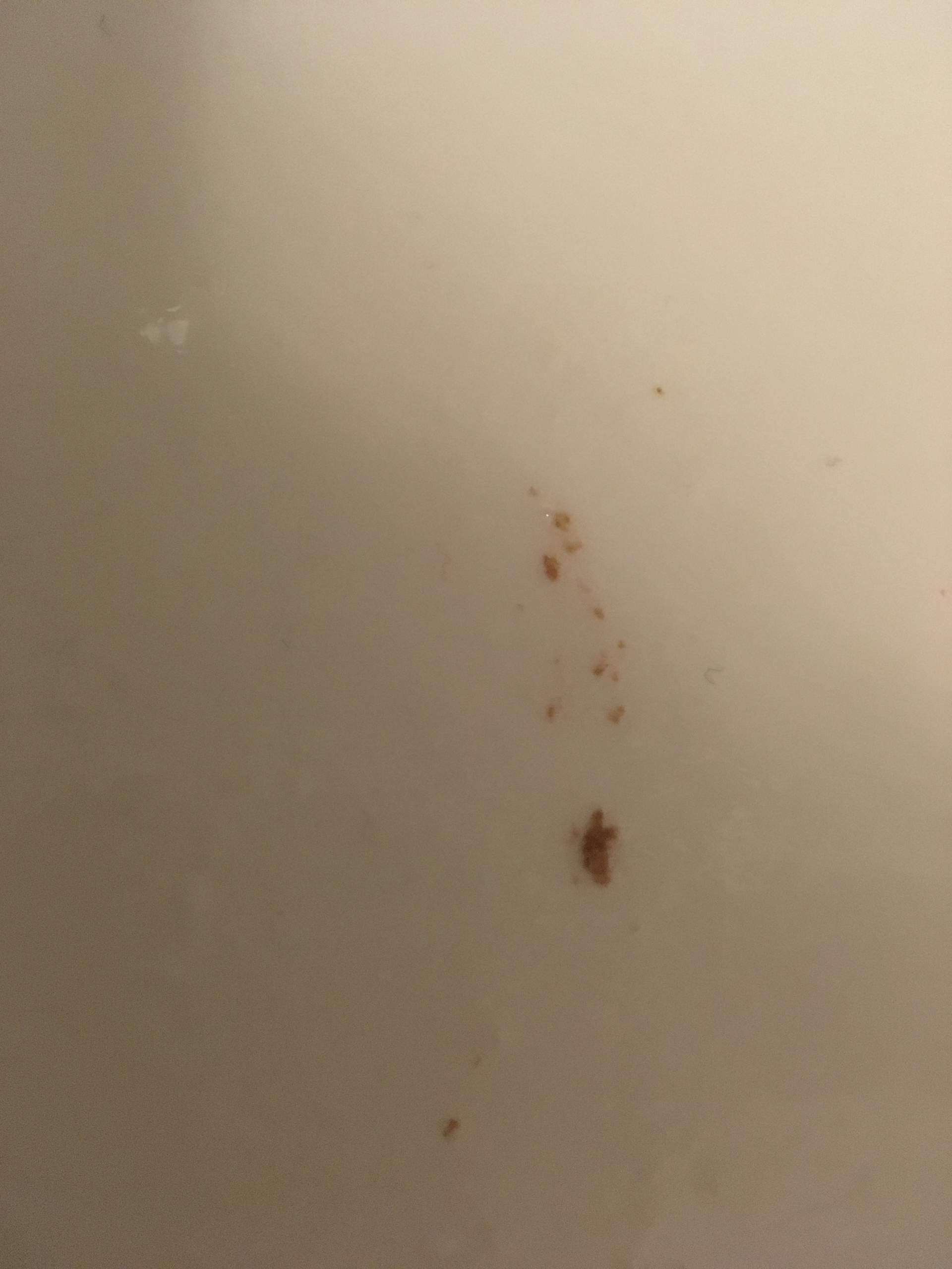 Ist das Blut im Speichel oder einfach Essen? (Gesundheit und Medizin