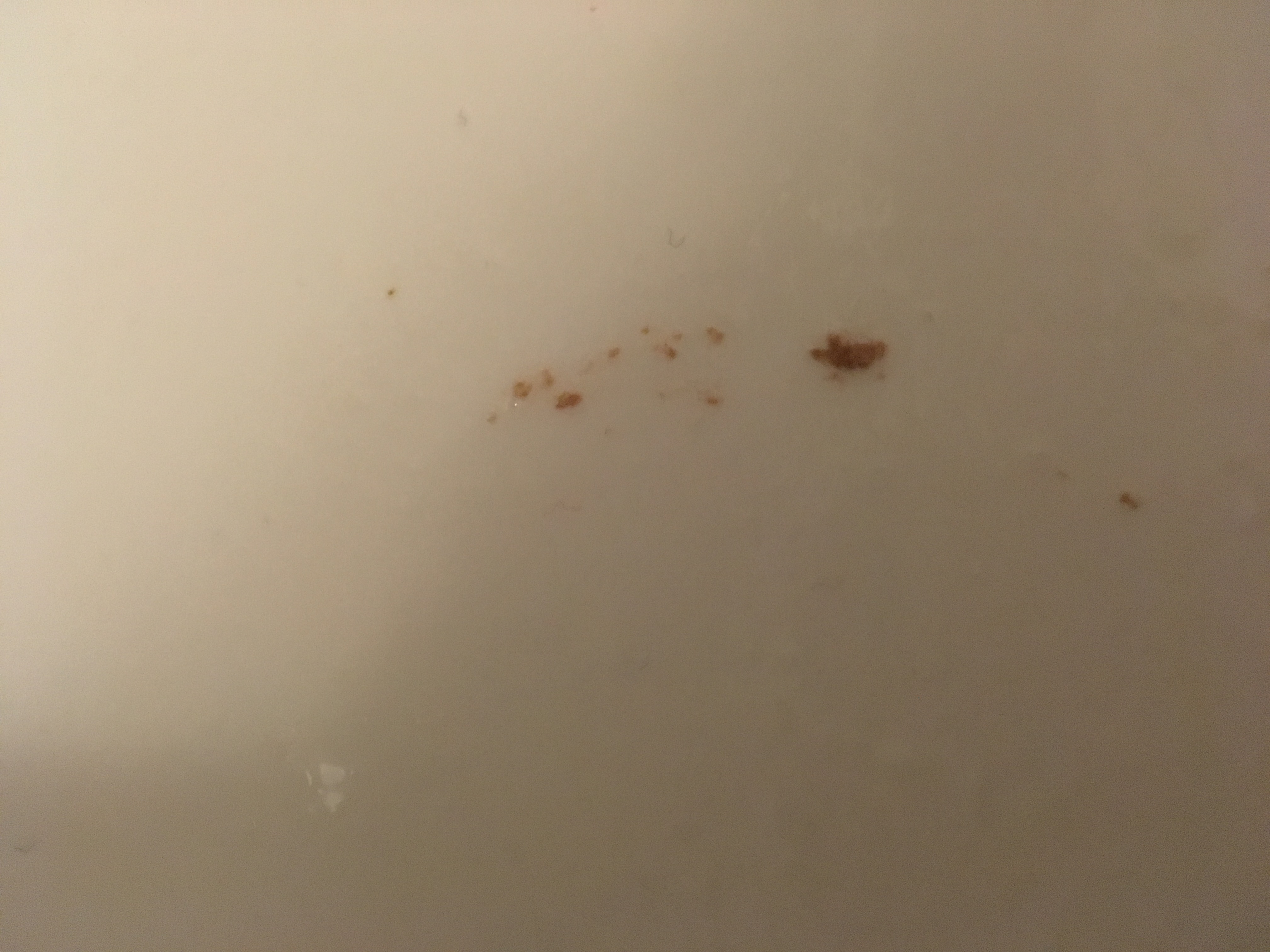 Ist das Blut im Speichel oder einfach Essen? (Gesundheit und Medizin