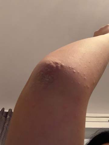 Kratze Die Meistgelesenen Fragen