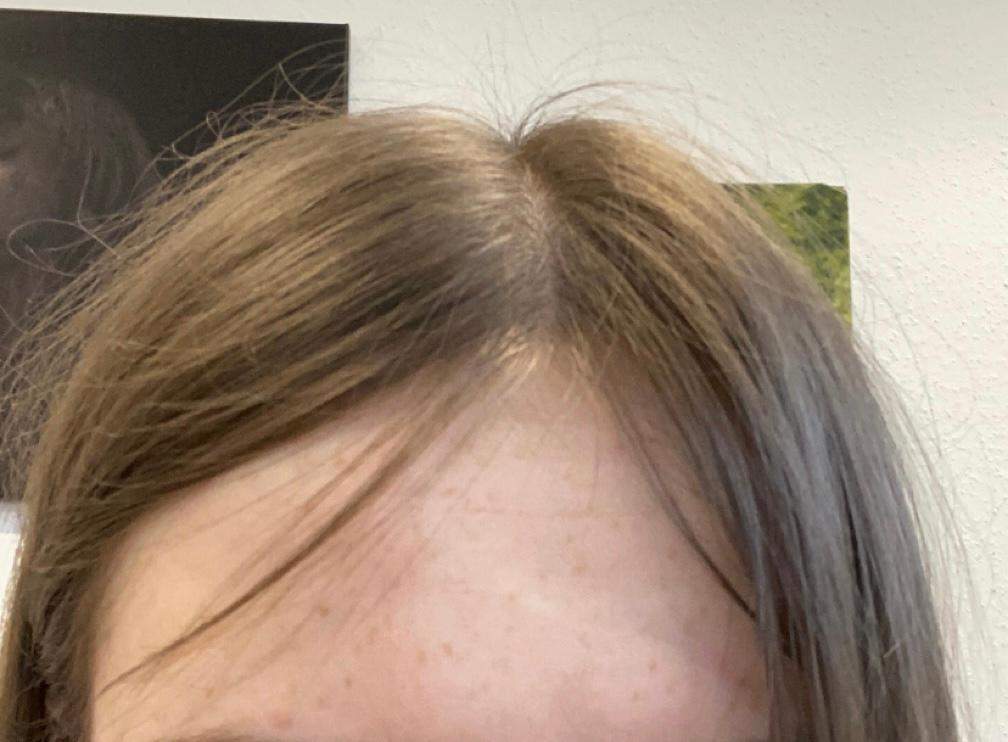 Ist das ein abgebrochenes Haar oder babyhaare? (Frauen, Aussehen, Friseur) Ist das ein abgebrochenes Haar oder babyhaare? (Frauen, Aussehen, Friseur)