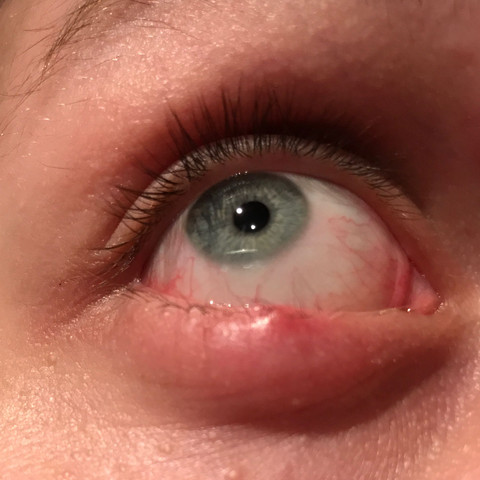 Das ist mein Rechtes Auge - (Gesundheit und Medizin, Schmerzen, Augen)