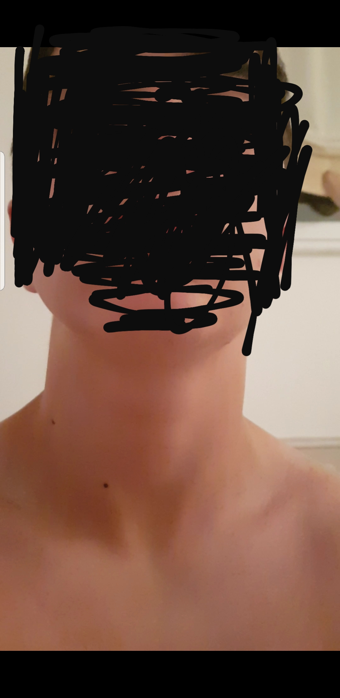 Ist Das Ein Hals Knoten Krankheit Meinung Ist Das Ein Hals Knoten Krankheit Meinung