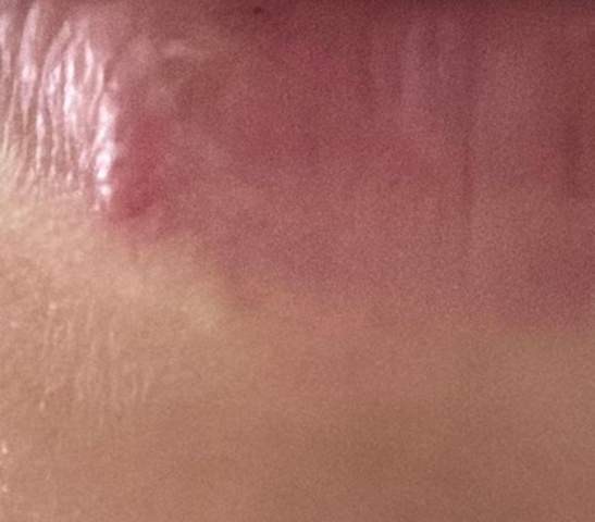 Bild zum Beitrag