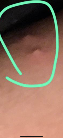 Ist Das Ein Hiv Auschlag