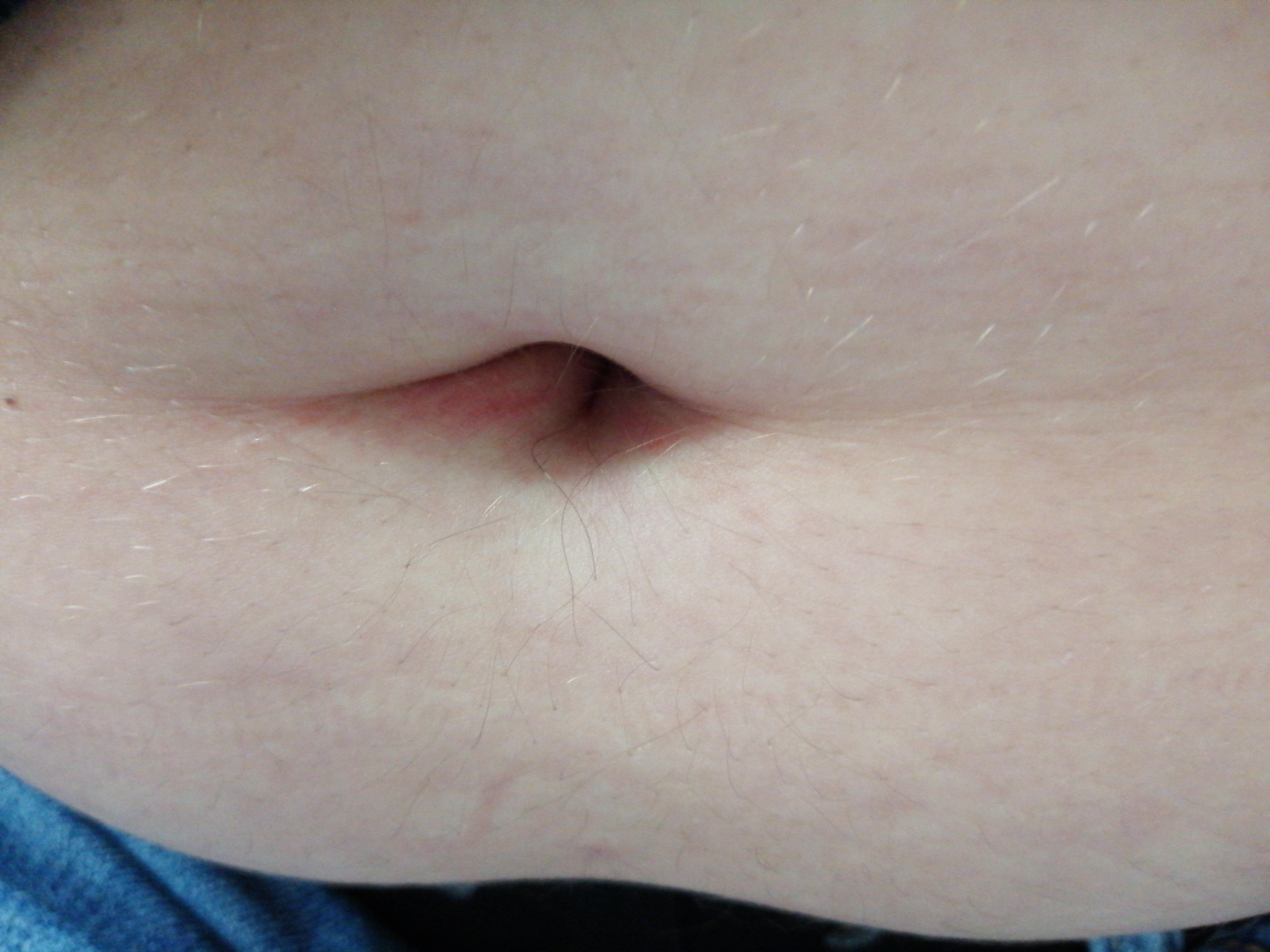 Ist Das Eine Bauchnabel Entzundung Medizin Korper Bauch Ist Das Eine Bauchnabel Entzundung Medizin Korper Bauch
