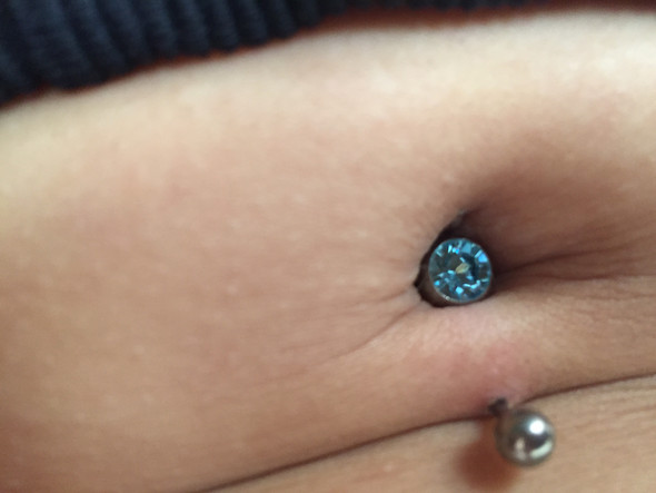 Entzündung ? - (Piercing, EntzÜndung)