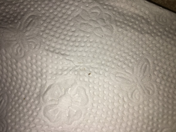 Ist Das Eine Kopflaus Unter Dem Nagel Haare Lause