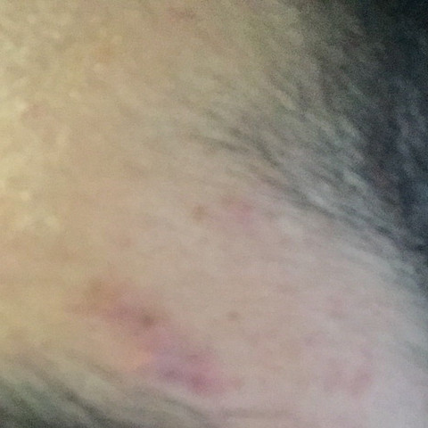 Hier das Bild - (Narben, Augenbrauen)