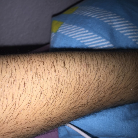 Hier
- (Haare, Arm)