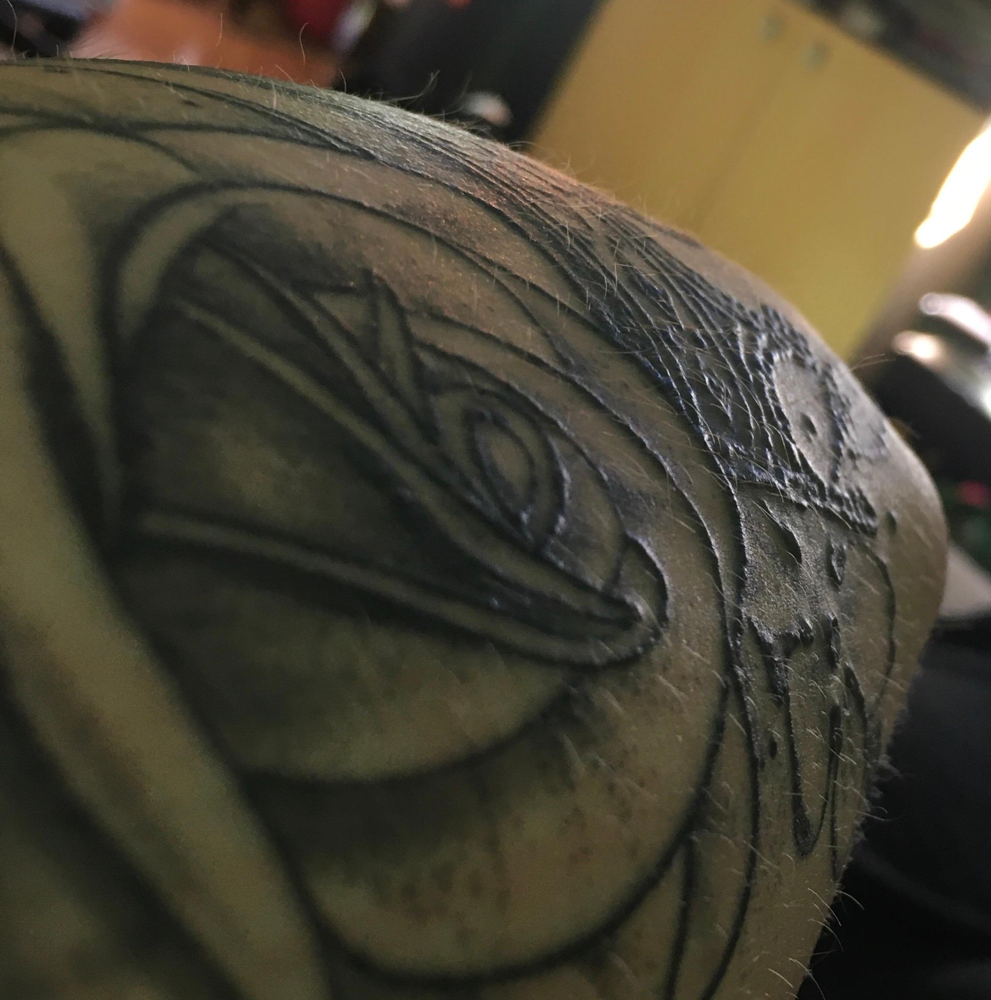 Ist das eine Tattoo Allergie? (Gesundheit und Medizin)