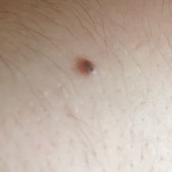 Zecke Die Meistgelesenen Fragen