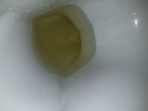 Der schäumt wenn urin Urin •