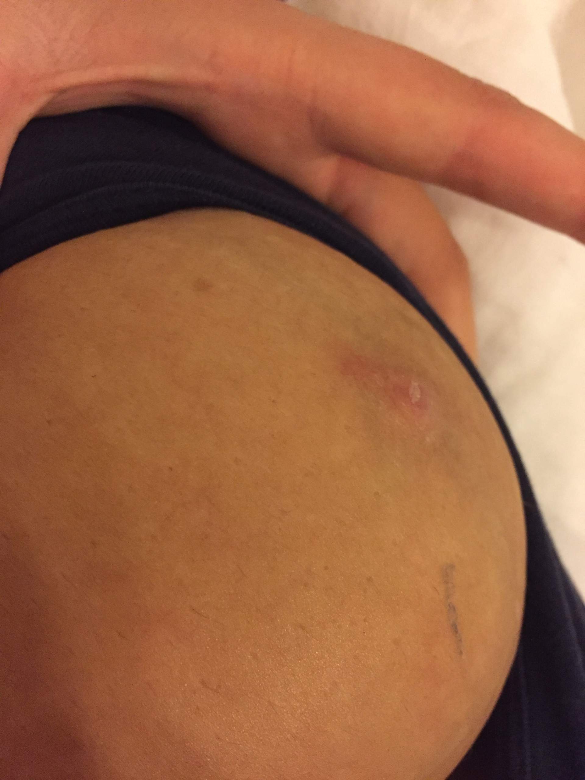 Ist Das Etwa Brustkrebs Gesundheit Und Medizin Gesundheit Medizin Ist Das Etwa Brustkrebs Gesundheit Und Medizin Gesundheit Medizin