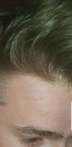 - (Gesundheit und Medizin, Haare, Leben)