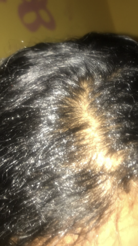 Ist Das Haarausfall Oder Niicht Gesundheit Haare