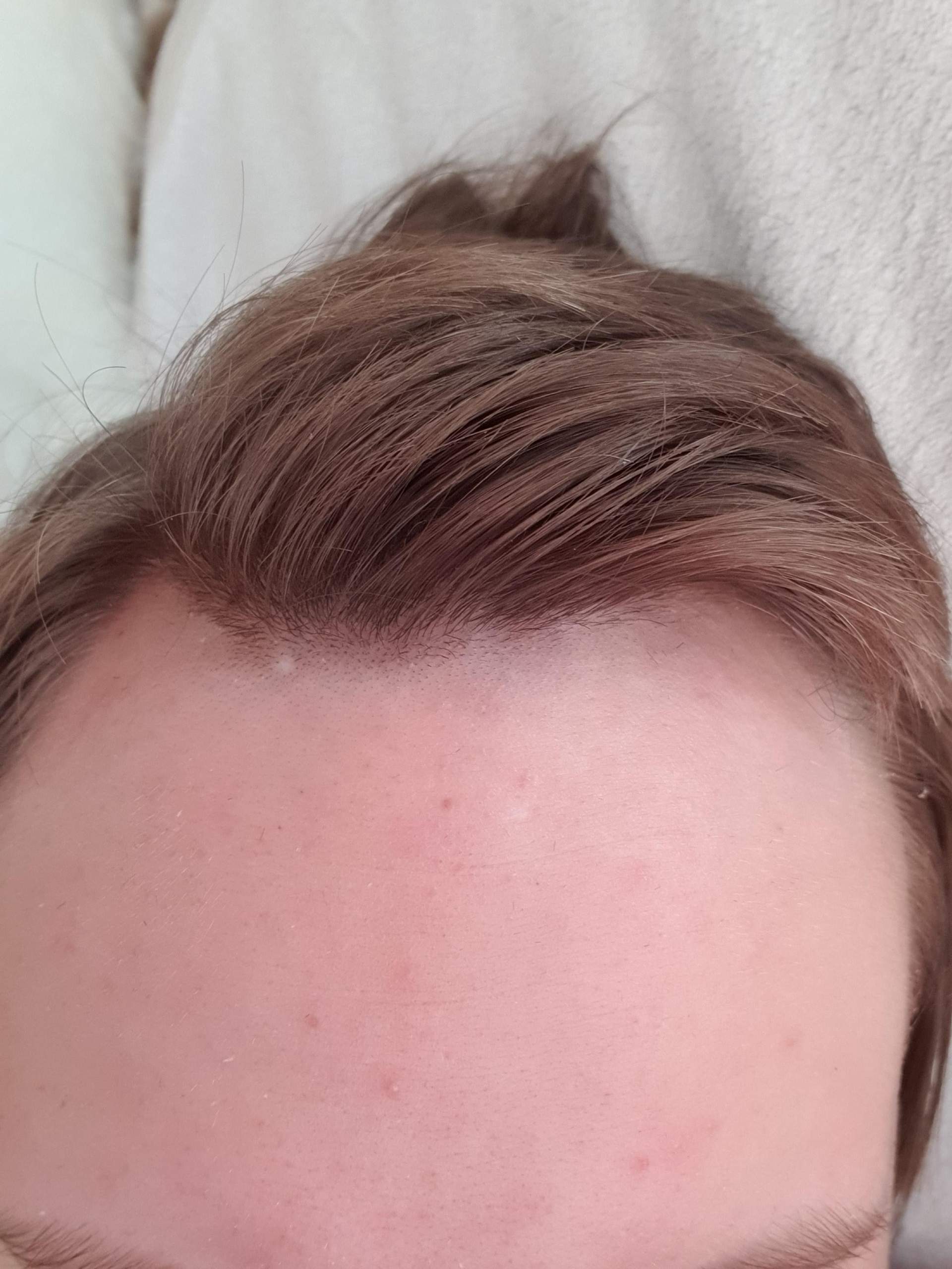 Ist das Haarausfall wenn ja was soll ich tun? (Frisur) schüsslersalze haarausfall