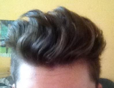 Momentaner Stand - (Haare, Haarausfall)