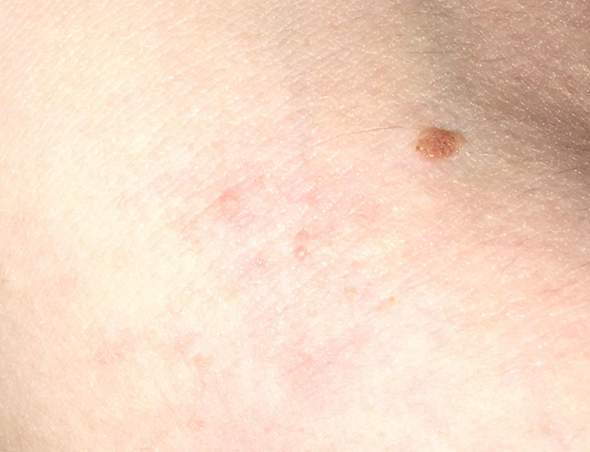 Ist Das Kratze Jucken Gesundheit Und Medizin Ist Das Kratze Jucken Gesundheit Und Medizin