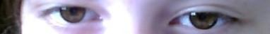 - (Augen, Asien)