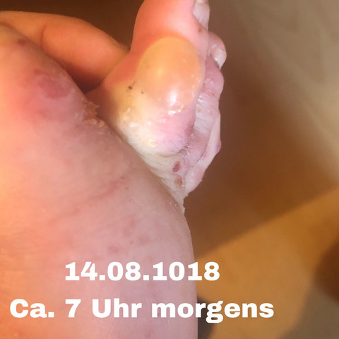 Ist Das Noch Kratze Gesundheit Und Medizin Krankheit Haut Ist Das Noch Kratze Gesundheit Und Medizin Krankheit Haut