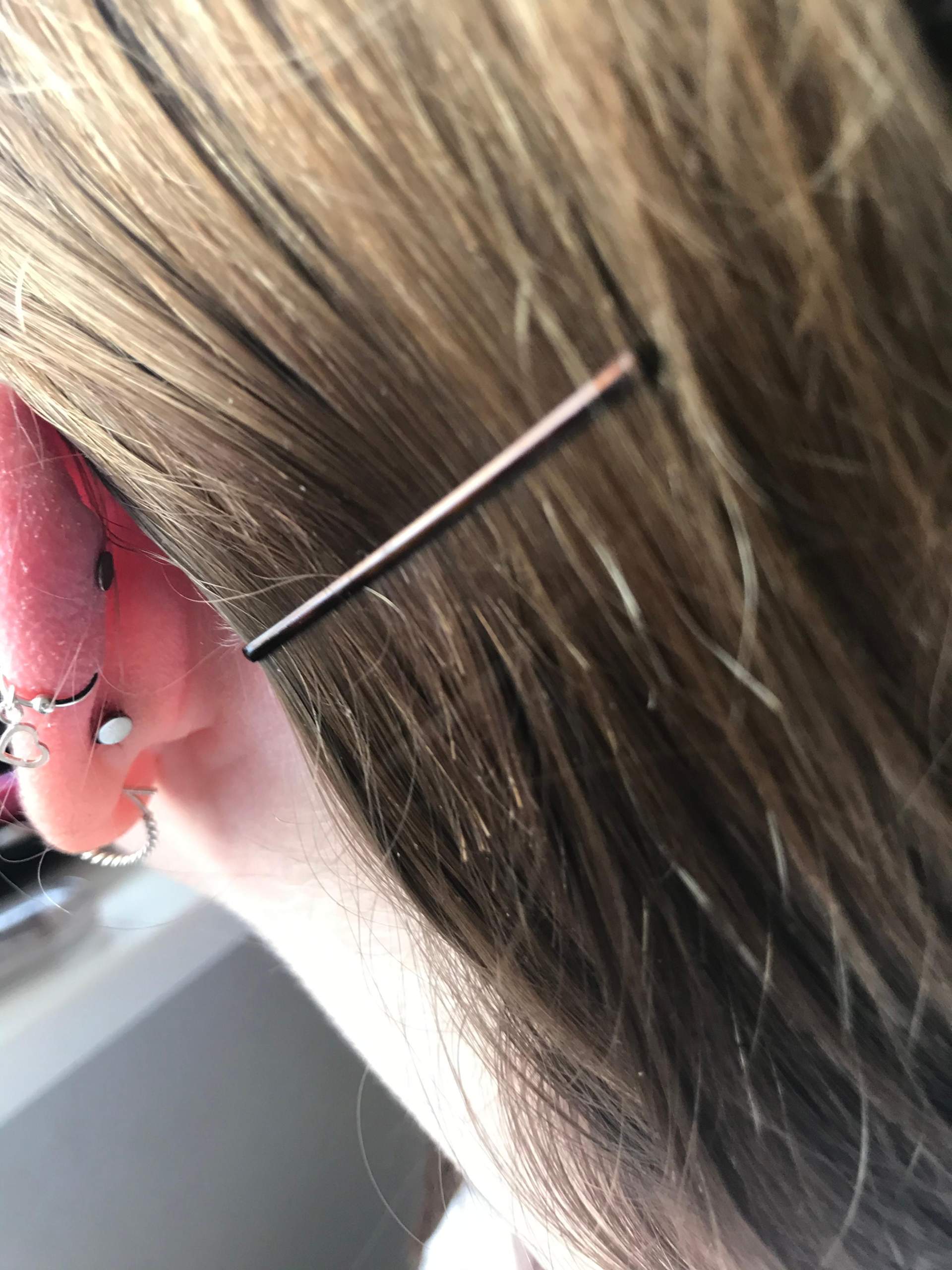 Helix Tut Weh Aber Nicht Entzündet Ist das noch Wildfleisch (Helix, Piercing)?