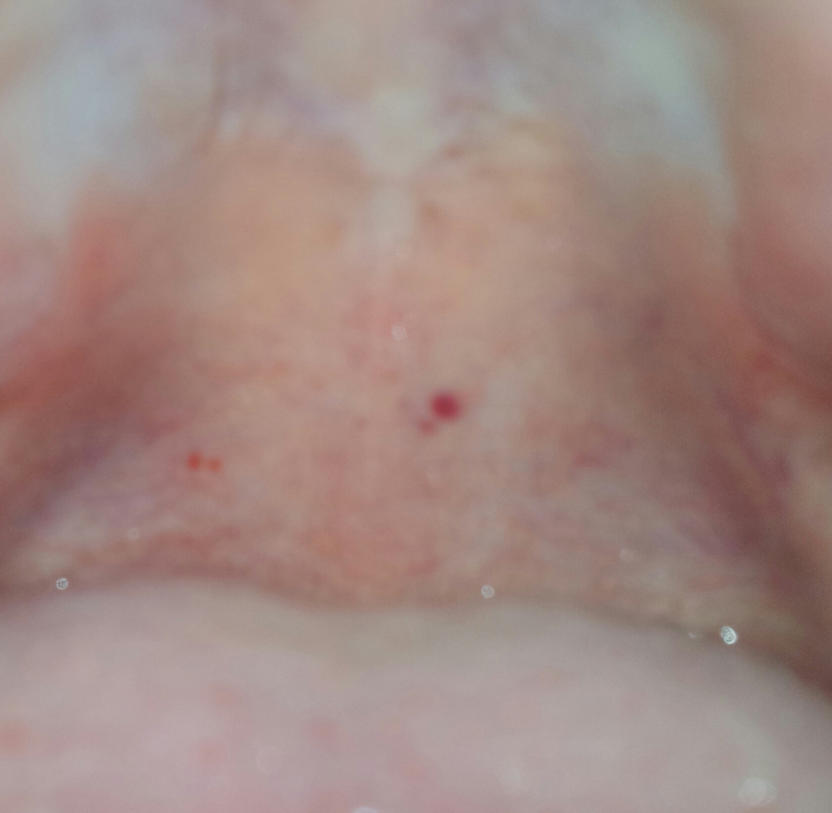 Ist das noemal im Mund? (Angst) Ist das noemal im Mund? (Angst)