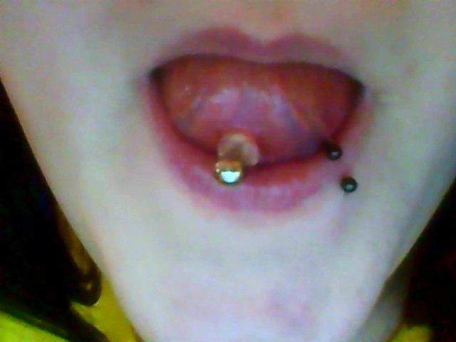 ist das normal oder sollte ich lieber zum piercer gehen piercing zunge zungenpiercing