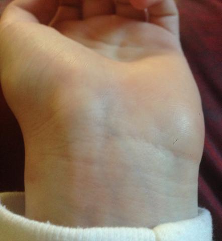Mein Handgelenk - (Gesundheit, Handgelenk)
