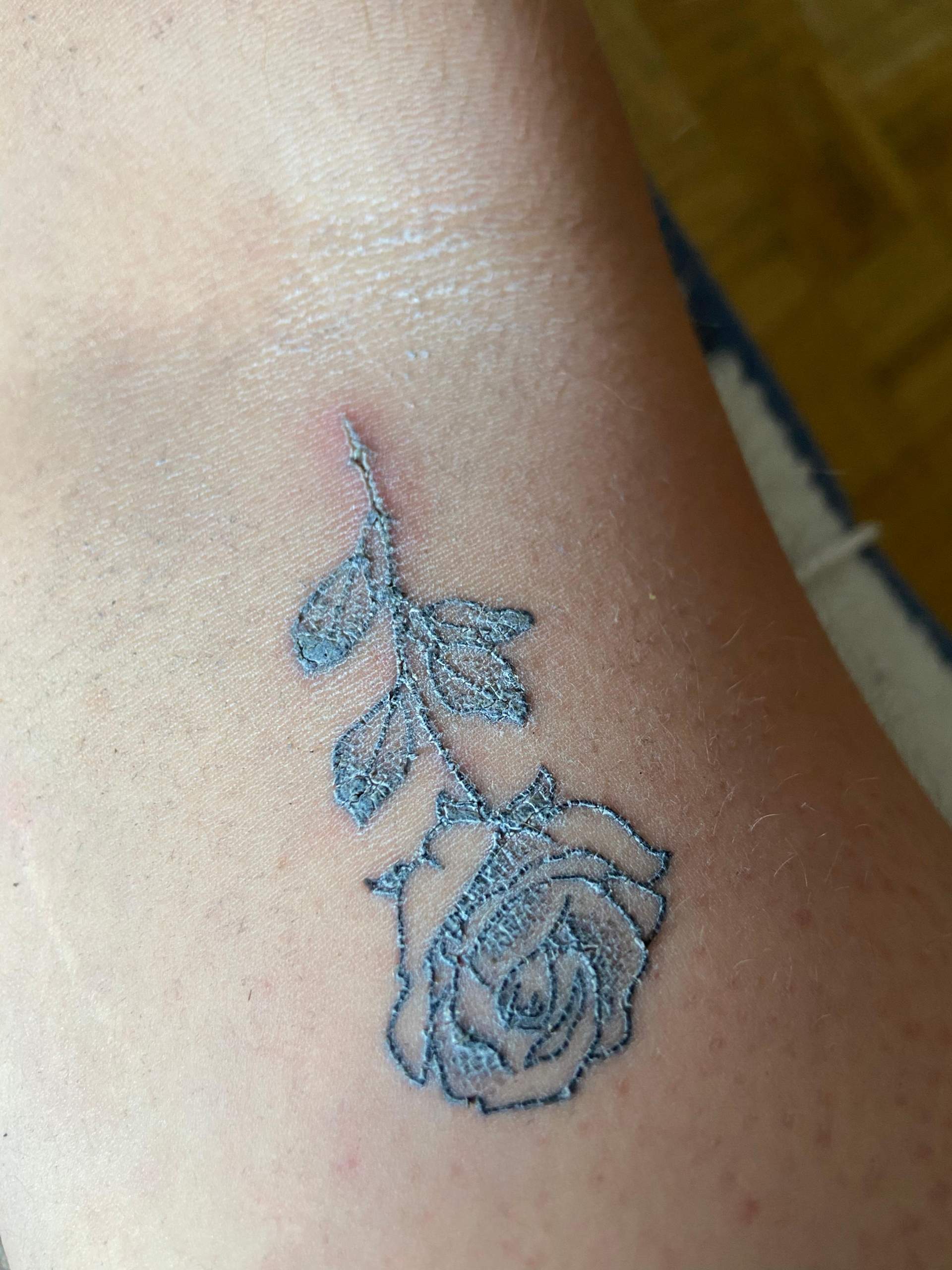 Ist das normal beim Tattoo (Bild)? (tätowieren, Tätowierung, Tattoostudio)