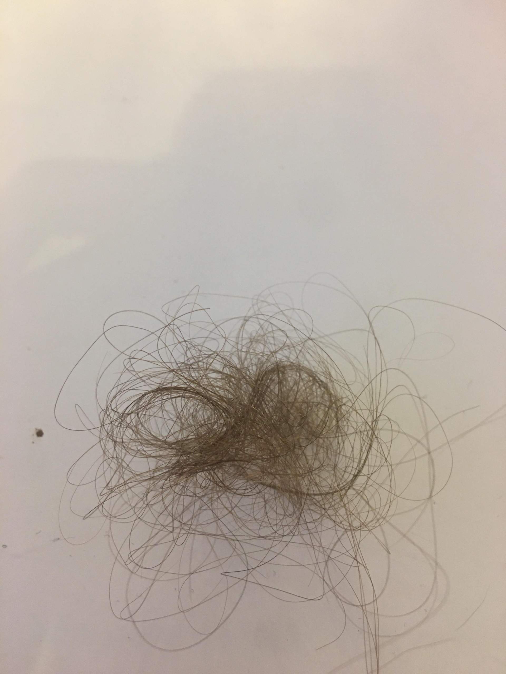 Ist das normal das man mit 13 Jahren so viele Haare verliert beim