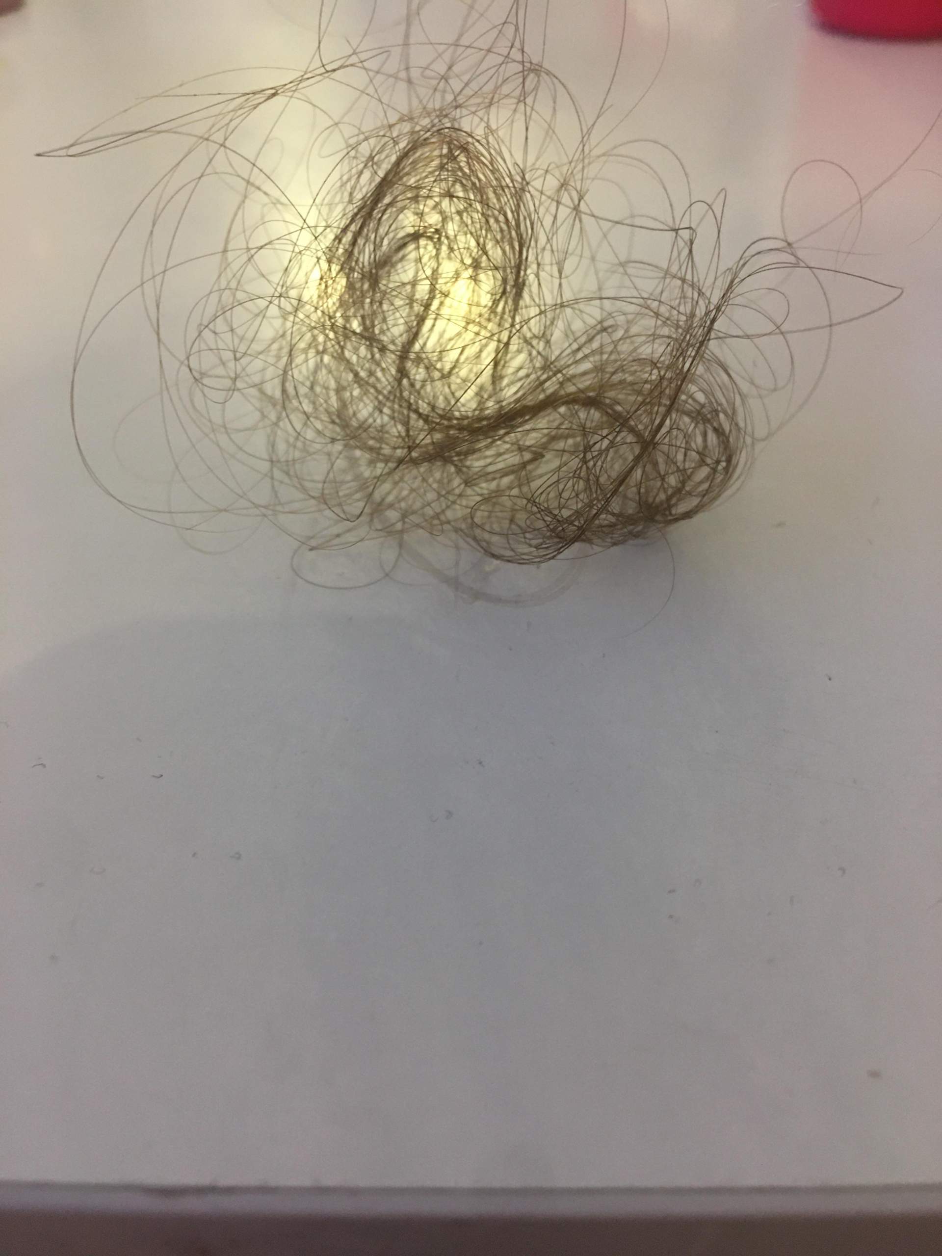 Ist das normal das man mit 13 Jahren so viele Haare verliert beim