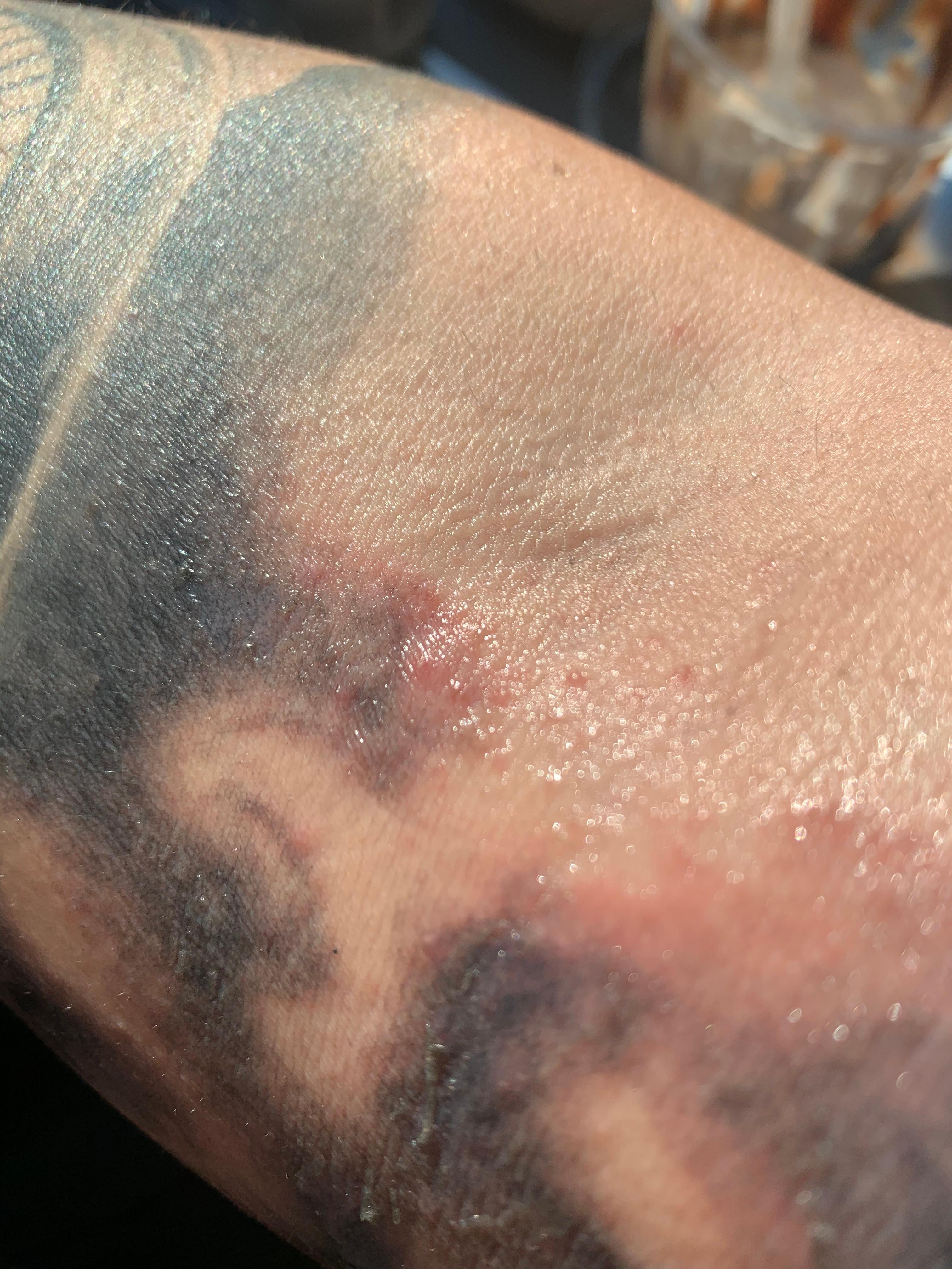 Ist das normal das mein tattoo nach dem stechen so aussieht