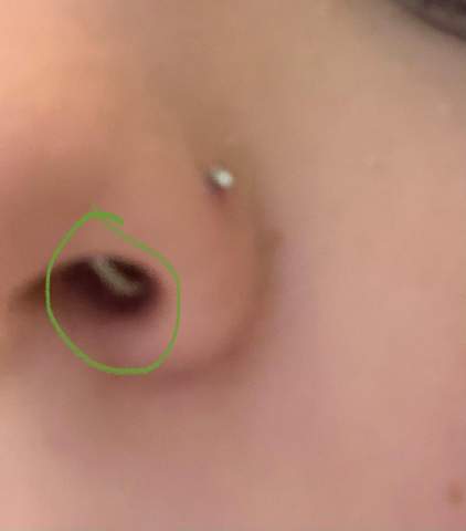 Ist das normal, dass die „Spirale“ vom Nasenpiercing innen ganze Zeit nach vorne rutscht so das man ihn sieht?