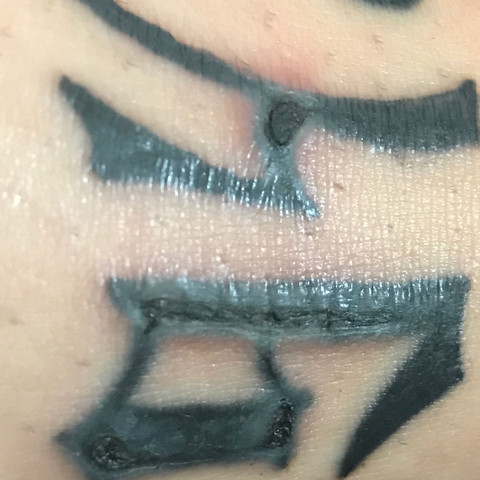 Ist Das Normal Nach 2 Wochen Tattoo Sorgen Ist Das Normal Nach 2 Wochen Tattoo Sorgen