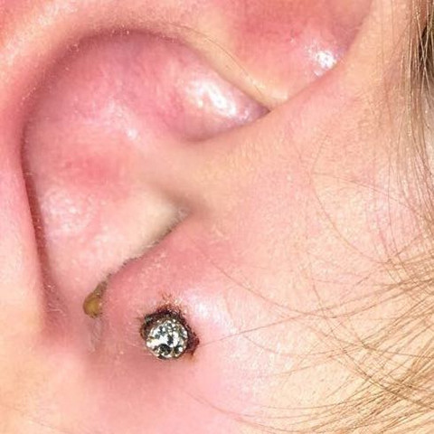 Ist Das Normal Tragus Piercing Gesundheit Und Medizin Schmerzen Tattoo